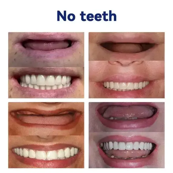 SmileFitPro™