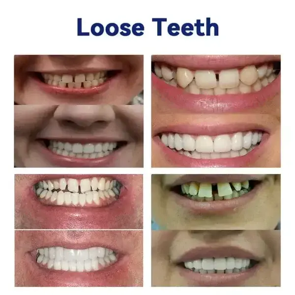 SmileFitPro™