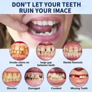 SmileFitPro™ New Generation Flexible Full Denture Solution
